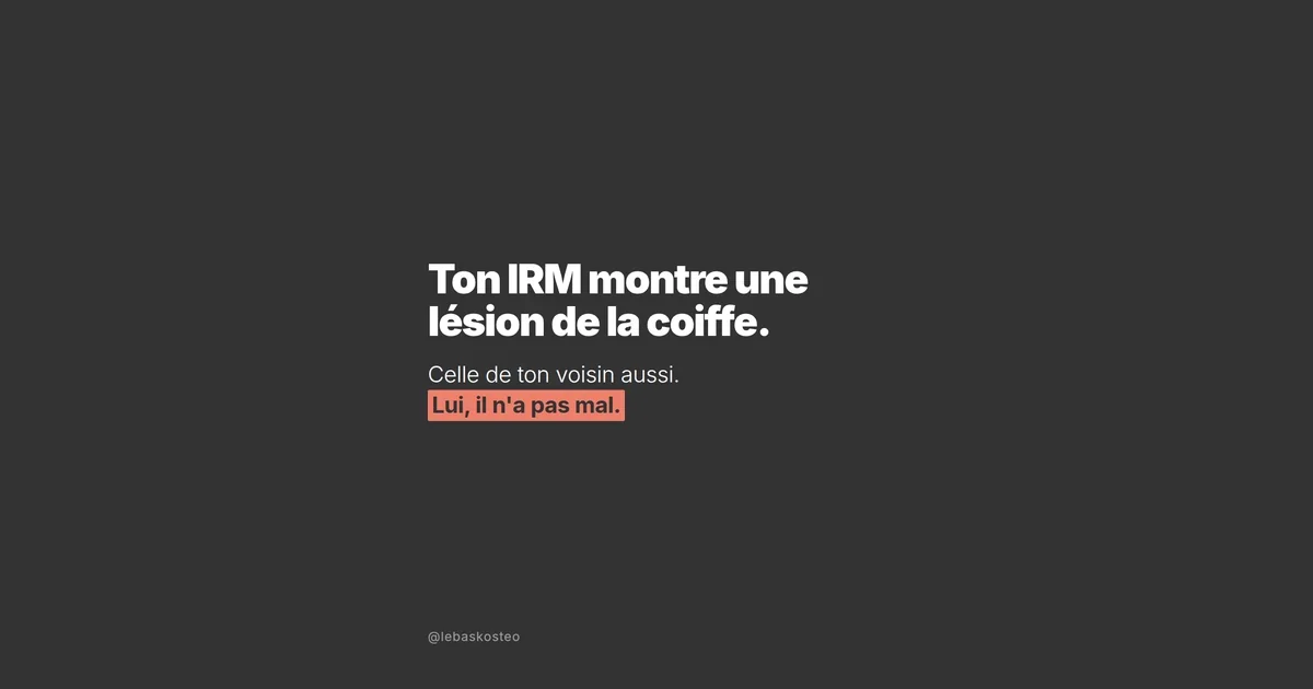 Ton IRM montre une lésion de la coiffe : ce que ça veut vraiment dire